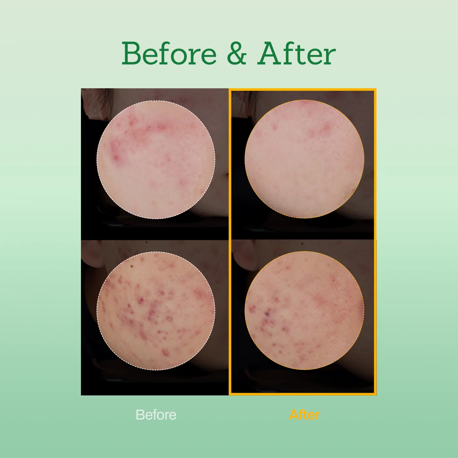 Mugwort Super Calming Toner - Image 7