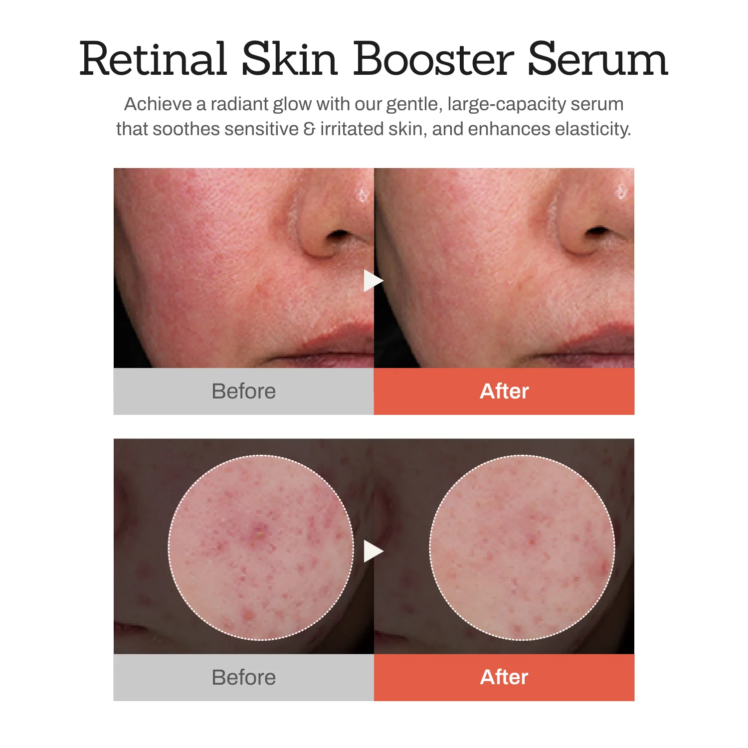 Retinal Skin Booster – All-in-One Glow Reset - Image 8