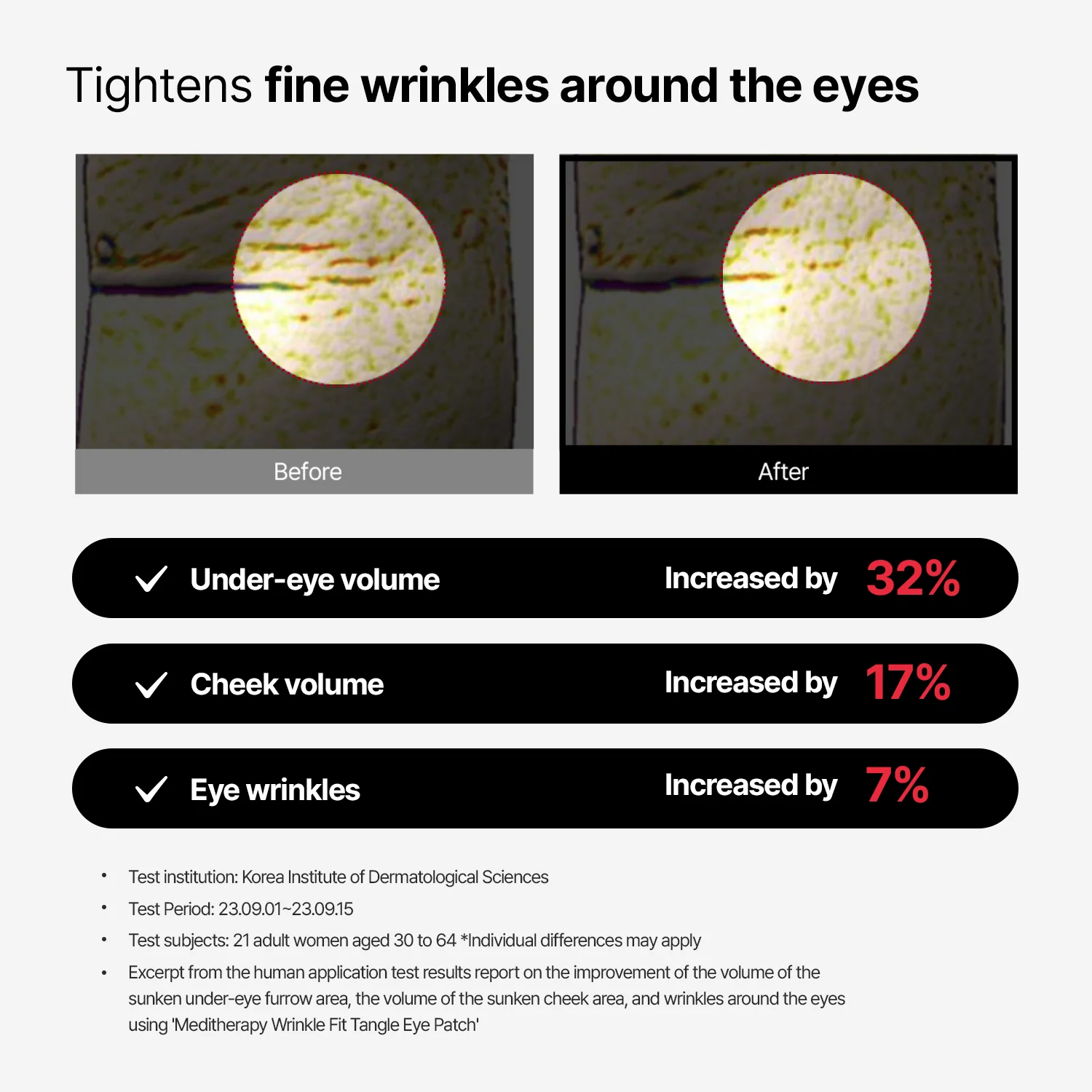 [56% OFF / $9.99] Wrinkle-Fit Tangle Eye Patch – Lowest Price Ever - Image 4