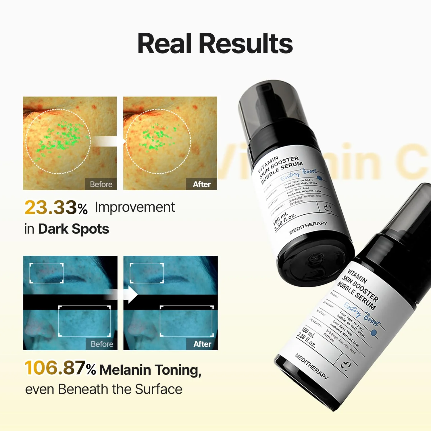 [New drop] Vitamin Skin Booster Bubble Serum – Non-Irritating Gentle Daily Brightening - Image 3