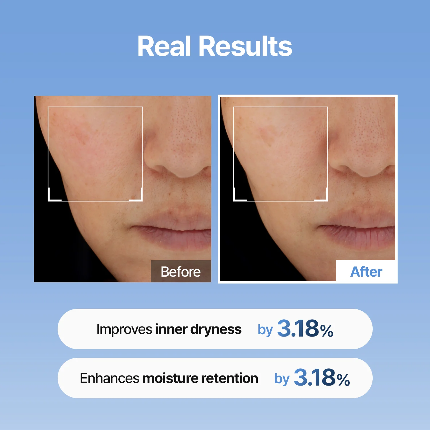 Hyaluronic Acid Skin Booster First Serum - 333Serum - Image 3