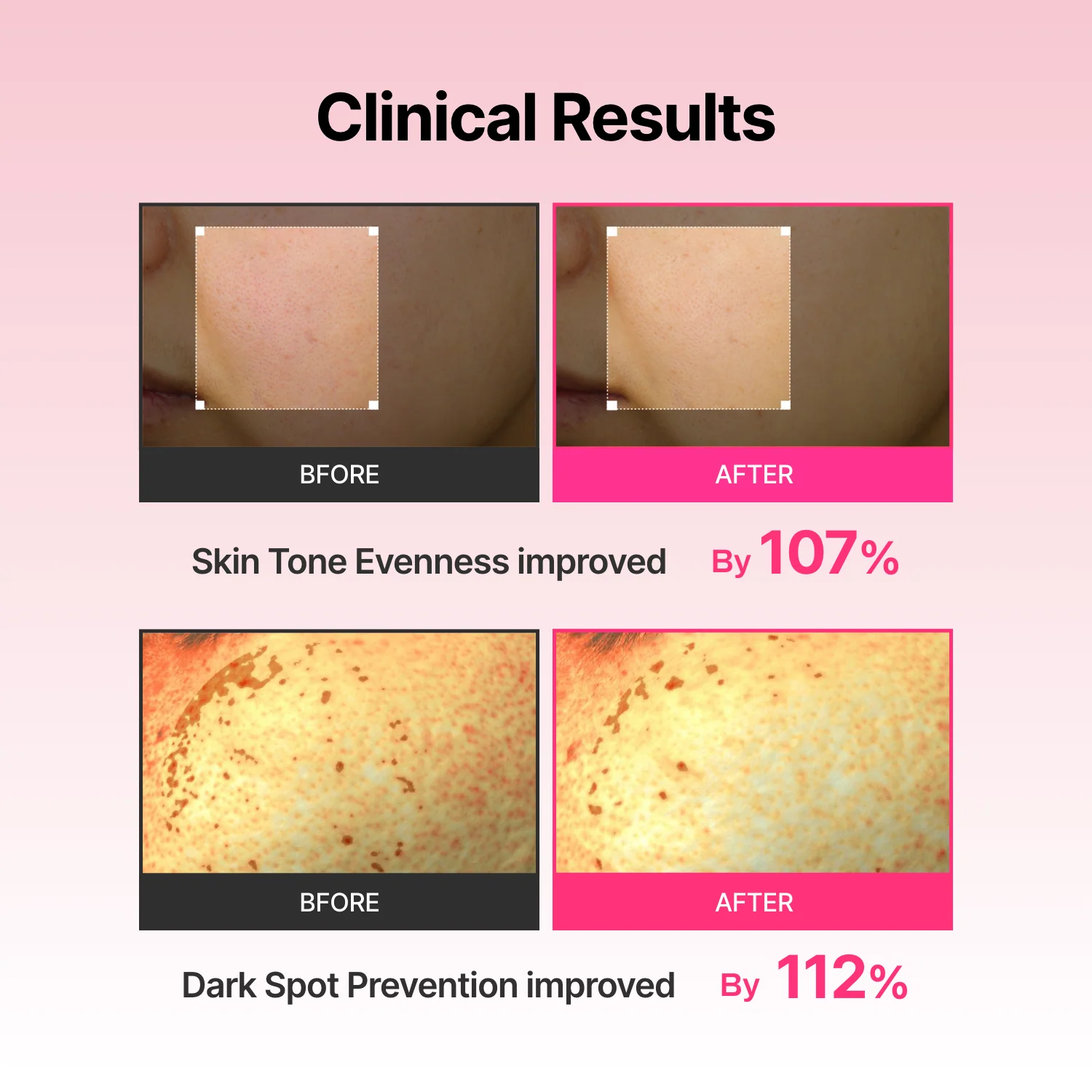 Arbutin Skin Booster Serum - Image 9