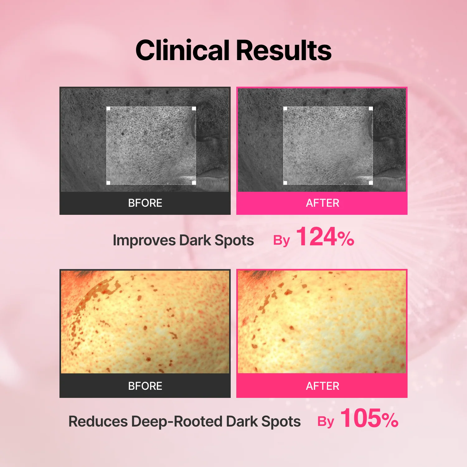 Tranexamic Acid Skin Booster – 4-Week Microcurrent Device & Cream - Image 3
