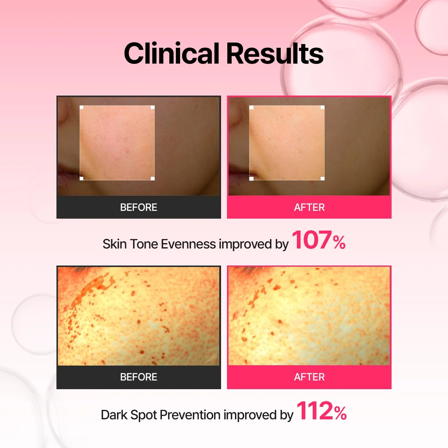 Arbutin Skin Booster Serum – 10% Niacinamide, 2% Arbutin, Boosts Absorption 7x with Built-In Device - Image 4