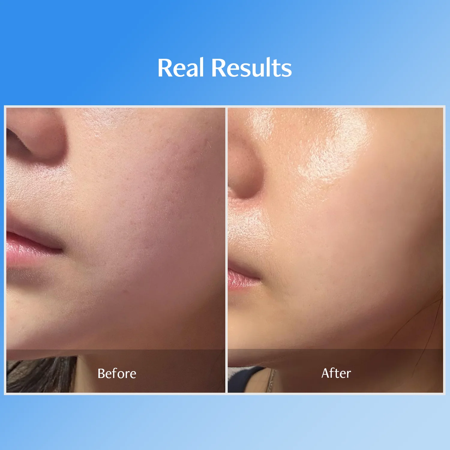 Bluelayer Ampoule Jet + Azulene Ampoule + Dome Mask + Water Cream - Image 20