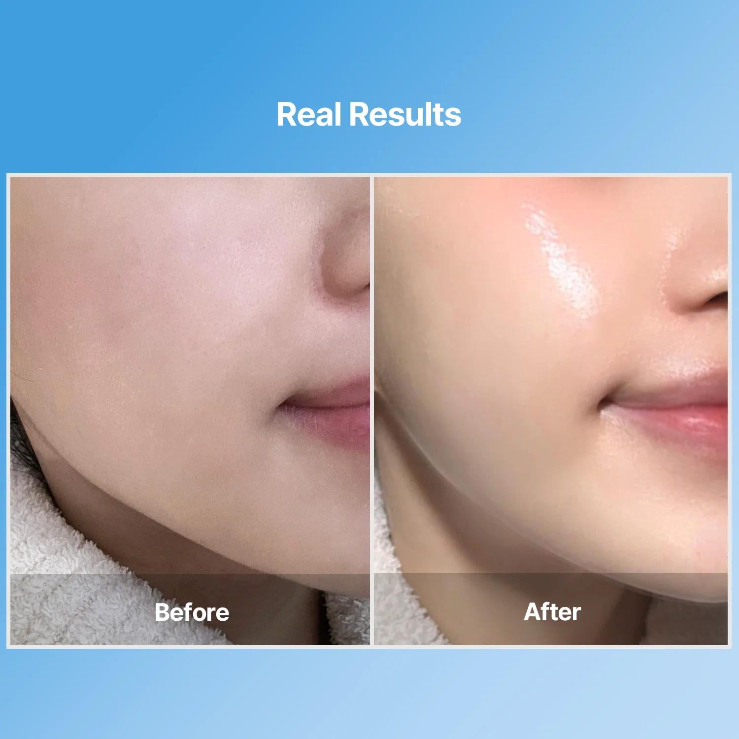 Bluelayer Water Dome Mask - Image 3