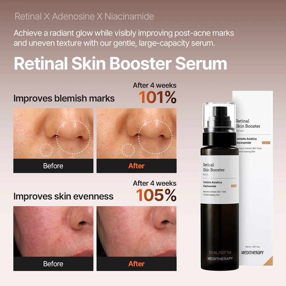 Dark Spot Reset Routine Set - Image 4
