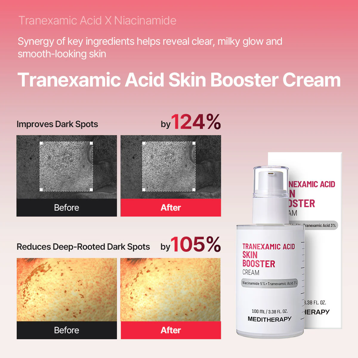 Dark Spot Reset Routine Set - Image 5