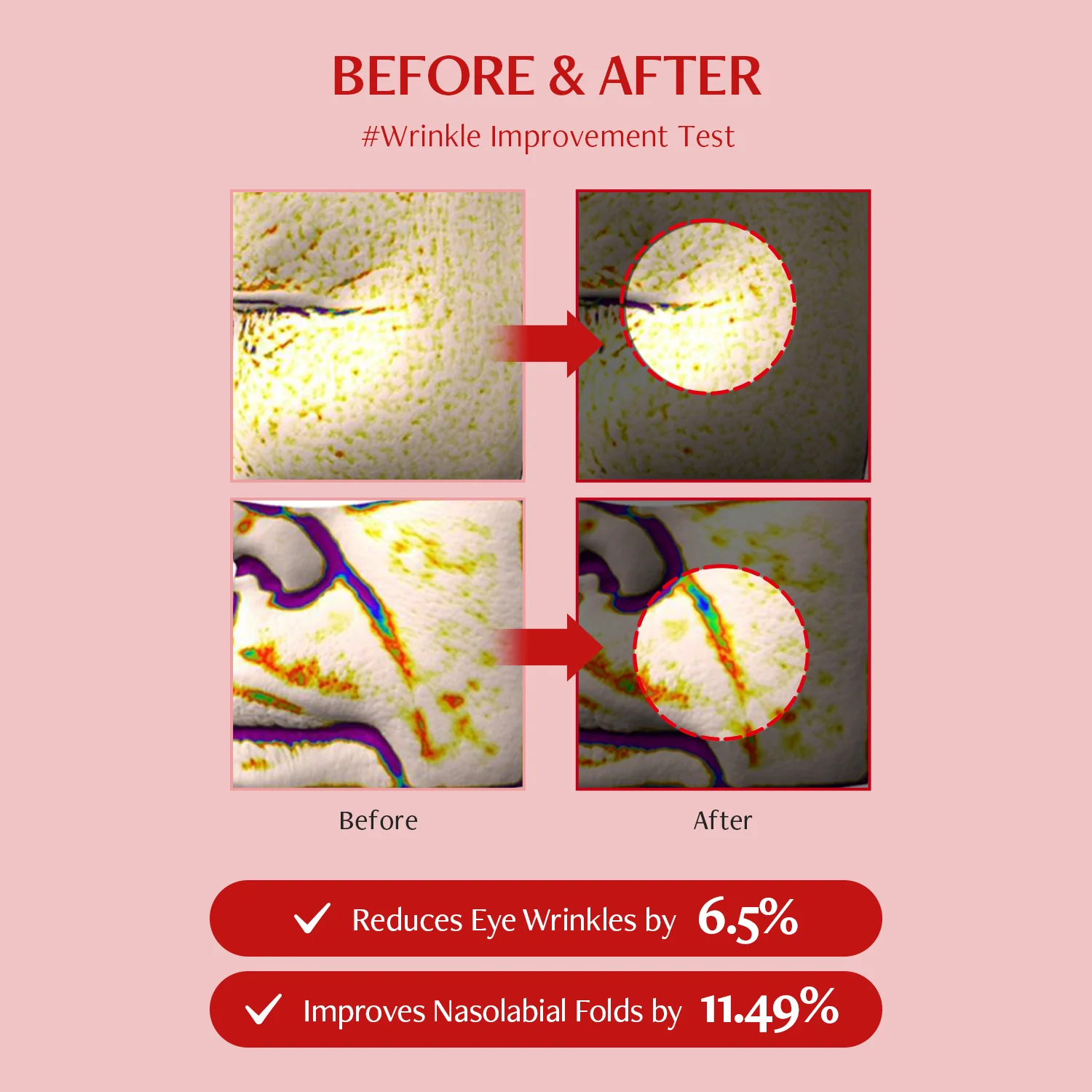Shumage Gold Seal Cream + Device + Gold Seal Ampoule + Wrapping Mask - Image 22
