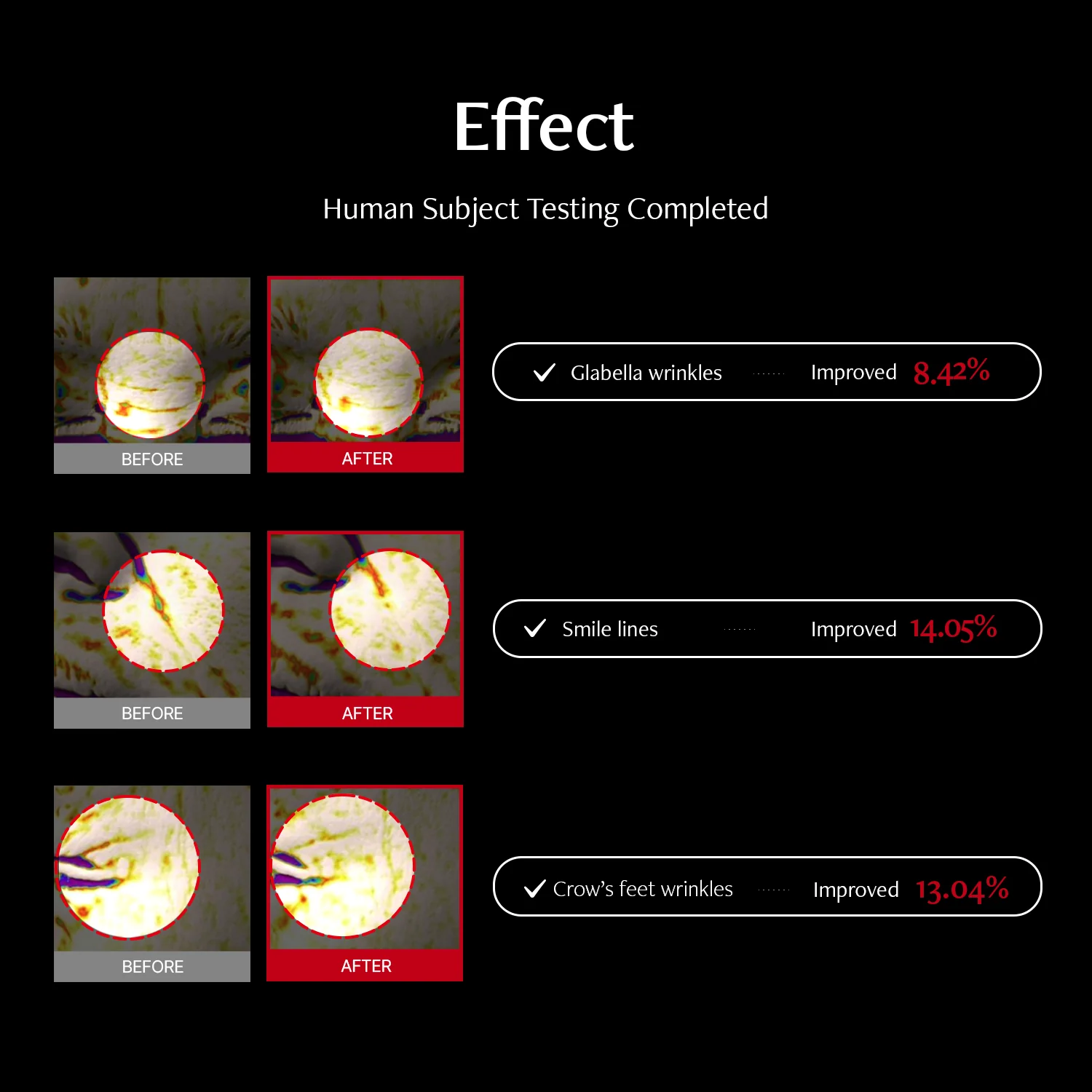 Shumage Retinol 550 Deep Shot Patch - Image 4