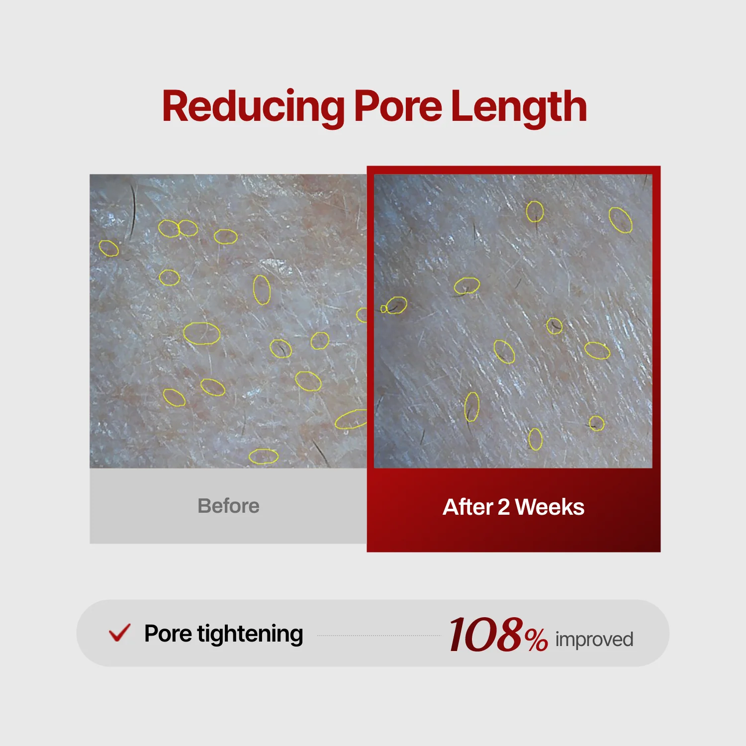Collagen Wrinkle-fit Mask - Image 10