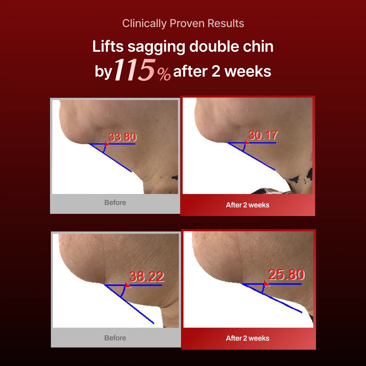 Collagen Wrinkle-fit Mask - Image 11
