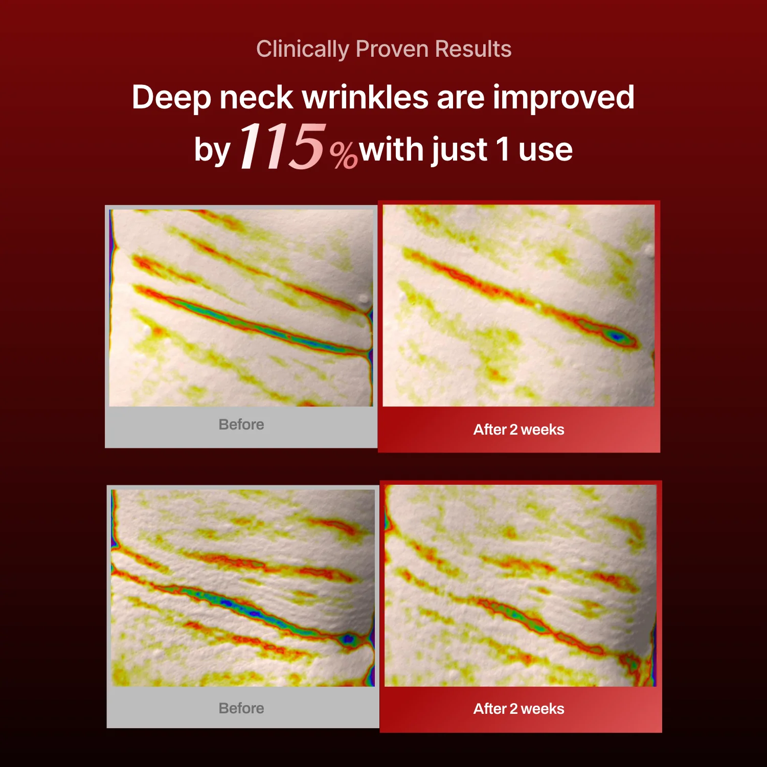 Collagen Wrinkle-fit Mask - Image 12