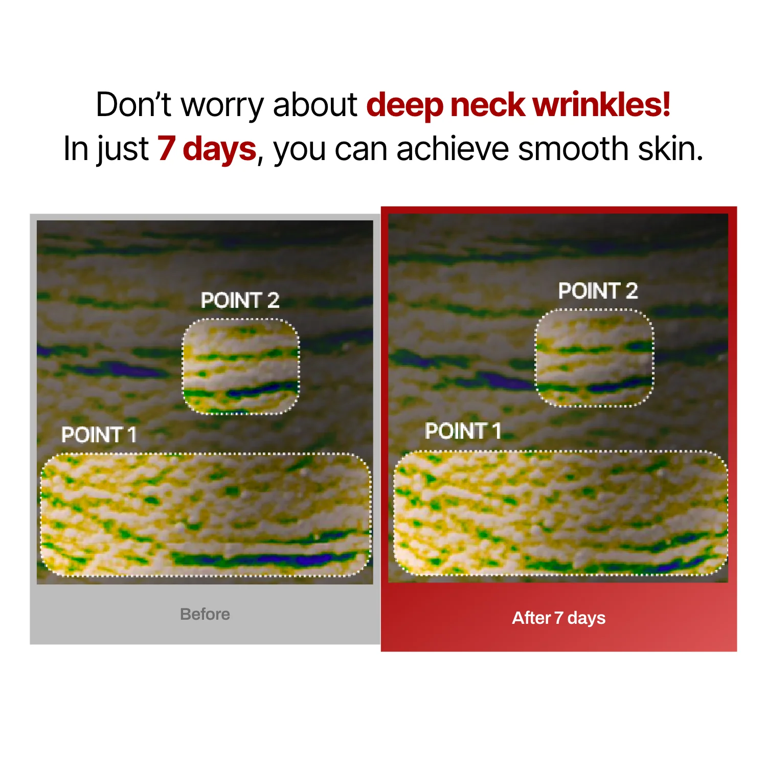 Collagen Wrinkle-fit Mask - Image 13