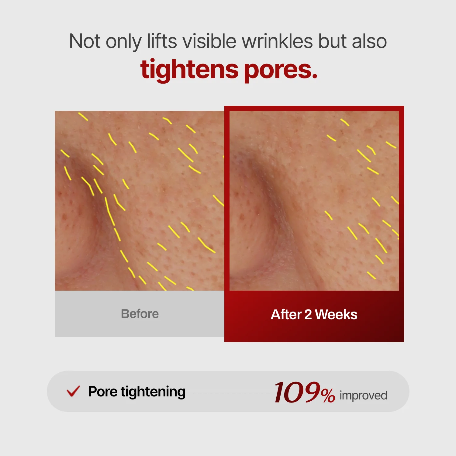 Collagen Wrinkle-fit Mask - Image 9