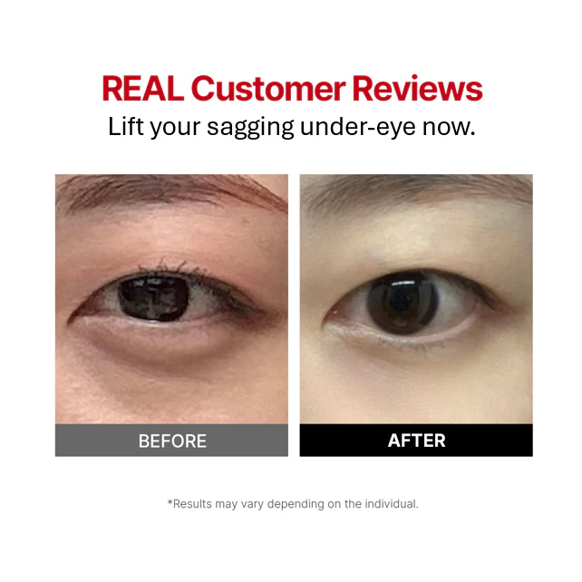 Wrinkle-fit Tangle Eye Cream - Image 5